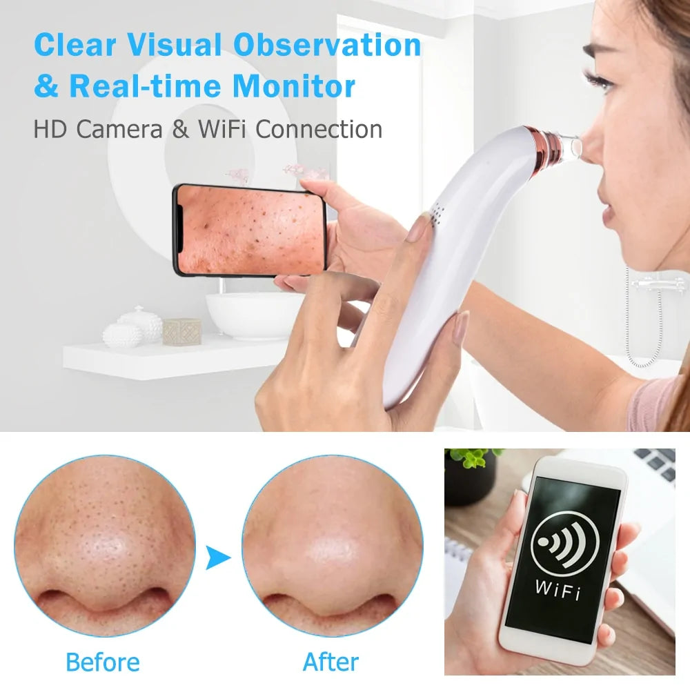 WiFi Blackhead Remover with Wireless Camera and Suction